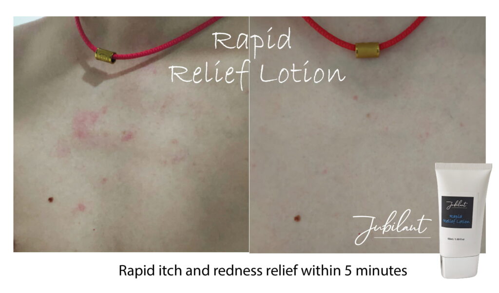 Rapid Relief Lotion